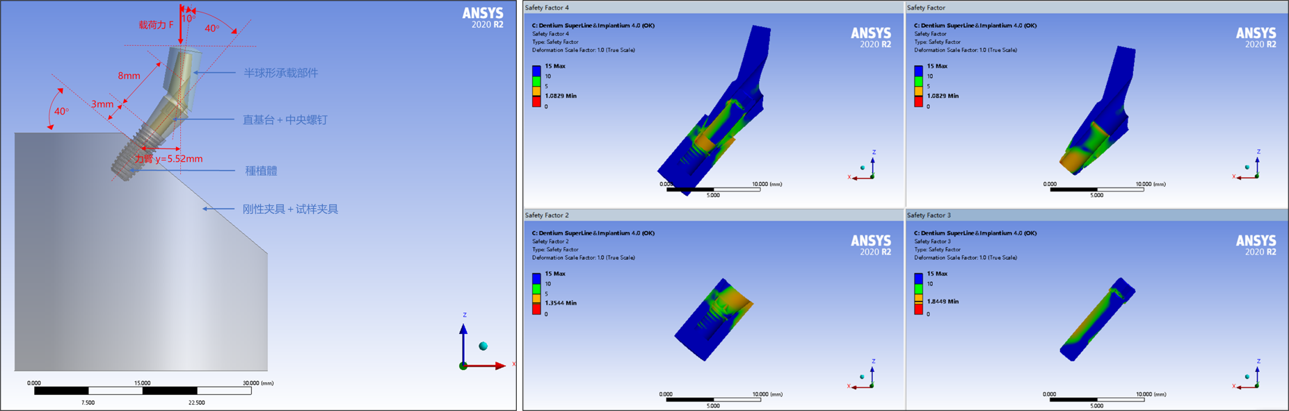 Load setup and finite element analysis of an implant abutment assembly
