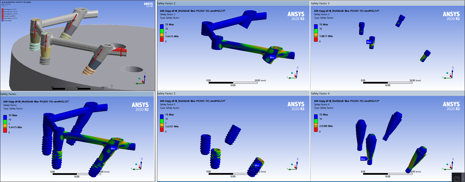 Structural model and finite element analysis of an implant bar and its connecting components