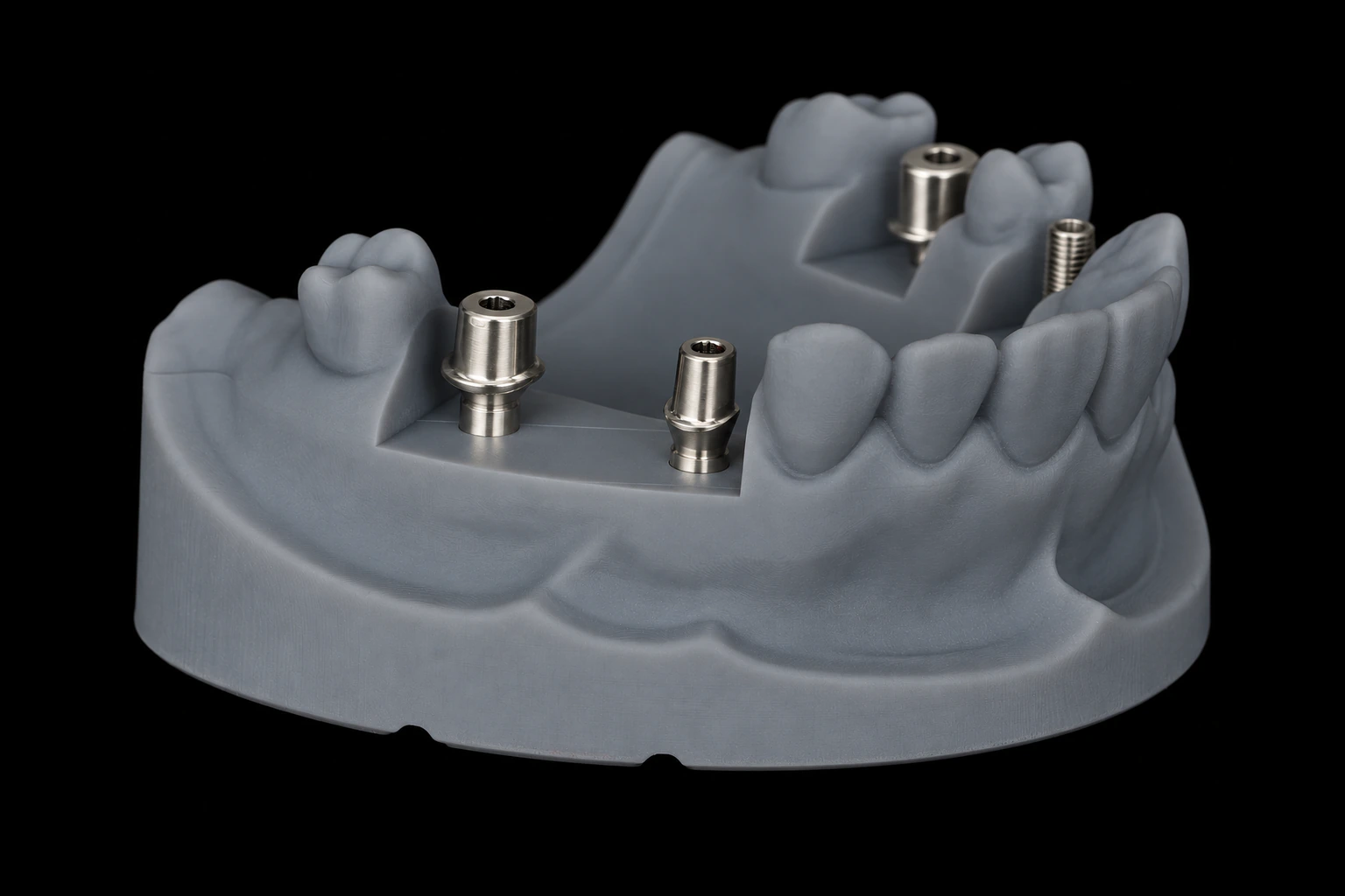 Titanium Custom Abutment